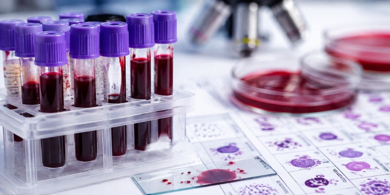 Especialista realizando estudios de hematología en laboratorio clínico